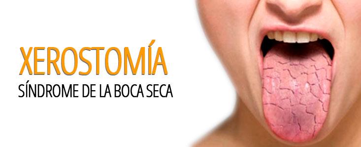Boca Seca o Xerostomía: Causas y Soluciones para Aliviarla