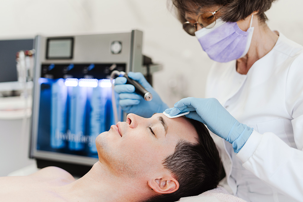 microneedling tipos