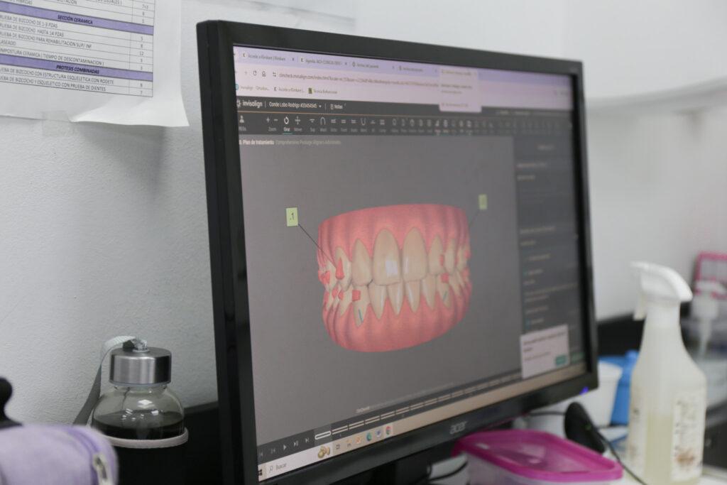Cómo prepararte para tu cita y qué esperar durante la planificación digital