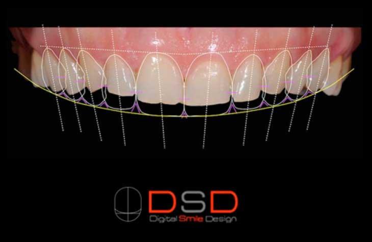 Ventajas de visualizar tu sonrisa digital para tomar decisiones informadas y sentirte seguro