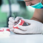 Reconstrucción con Composite: Recupera tu Sonrisa de Forma Estética y Duradera