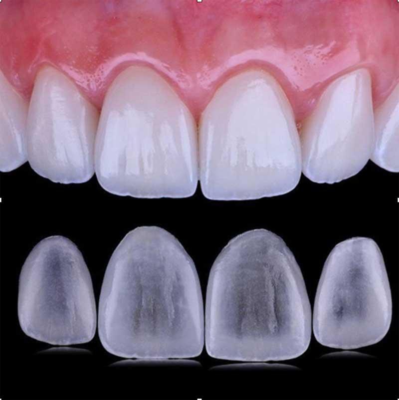 Prepárate para comunicar claramente tus expectativas y deseos al dentista