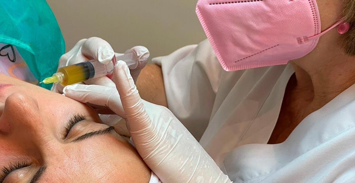 Descubre las recomendaciones clave para preparar tu piel antes de aplicar PRP
