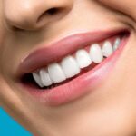 Diseño de Sonrisa Digital (DSD): Visualiza tu Sonrisa Ideal Antes de Empezar el Tratamiento