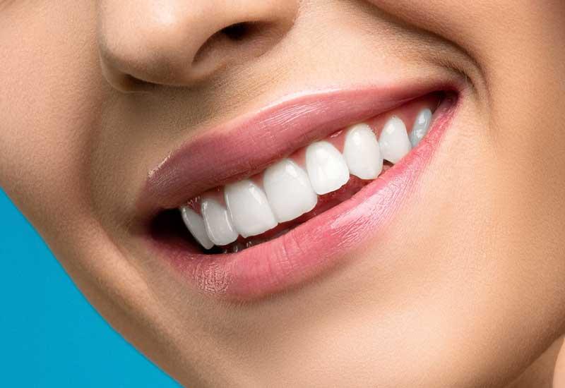 Diseño de Sonrisa Digital (DSD): Visualiza tu Sonrisa Ideal Antes de Empezar el Tratamiento