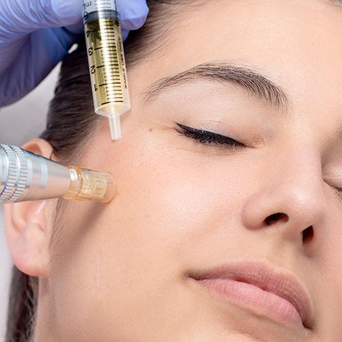 Explora los beneficios específicos del PRP para rejuvenecer tu piel y mejorar su textura