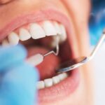 La Salud de tu Boca y su Impacto en el Cuerpo: Más Allá de los Dientes