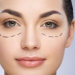 Tratamiento de Ojeras: Cómo Eliminar las Bolsas y el Color Oscuro sin Cirugía