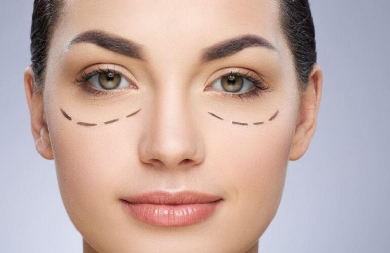 Tratamiento de Ojeras: Cómo Eliminar las Bolsas y el Color Oscuro sin Cirugía