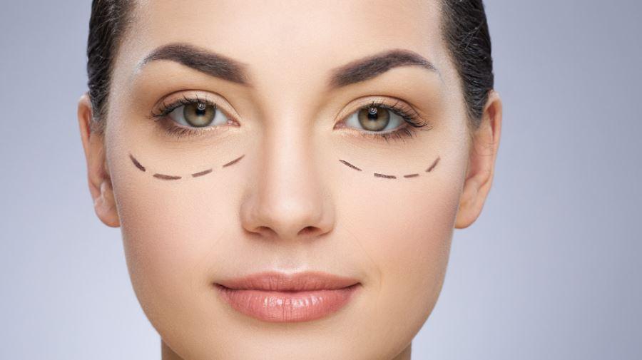 Tratamiento de Ojeras: Cómo Eliminar las Bolsas y el Color Oscuro sin Cirugía