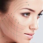 Hilos Tensores: El Lifting Facial sin Cirugía para Combatir la Flacidez