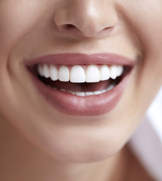 Mantener blanqueamiento dental