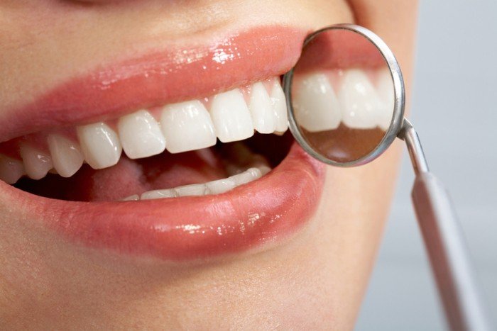 Manchas Blancas en los dientes