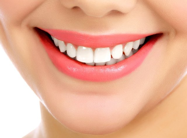 Smile Makeover