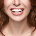 Smile Makeover: Qué es una Rehabilitación Estética Completa y Cómo Transforma tu Sonrisa