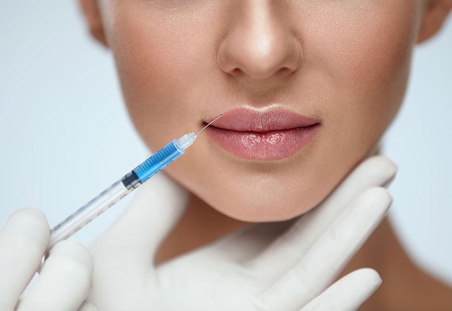 Estética Perioral: Cómo el Ácido Hialurónico en Labios y Surcos Enmarca tu Sonrisa