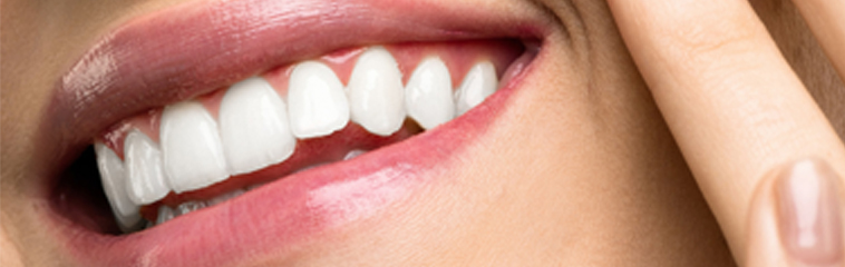 mantener blanqueamiento dental