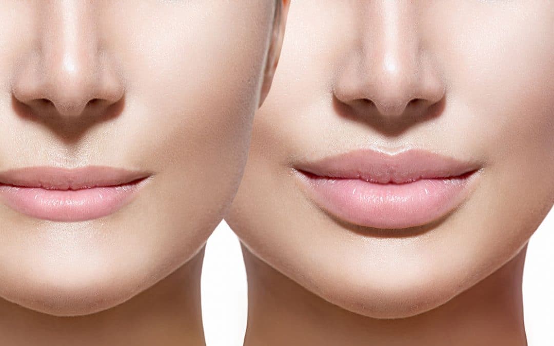 Estética Perioral