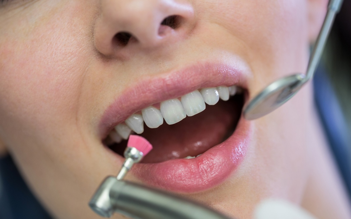 Dientes Conoides y Microdoncia