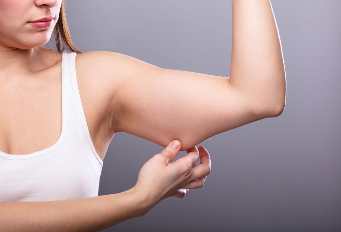 Tratamientos para la Flacidez Corporal: Recupera la Firmeza en Brazos, Abdomen y Piernas