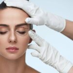 Blefaroplastia sin Cirugía: Levanta tus Párpados Caídos y Rejuvenece tu Mirada