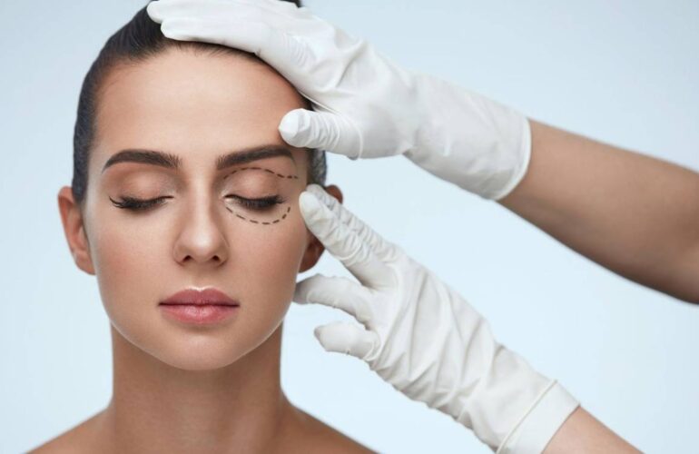 Blefaroplastia sin Cirugía: Levanta tus Párpados Caídos y Rejuvenece tu Mirada