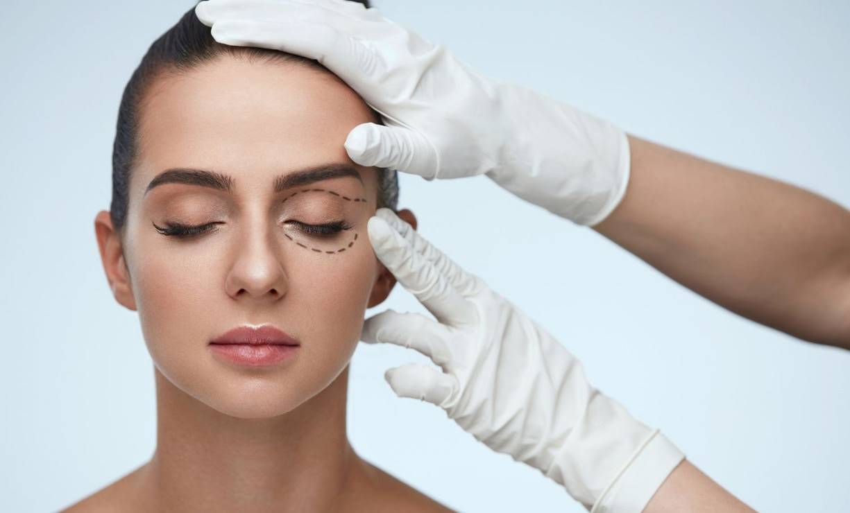 Blefaroplastia sin Cirugía: Levanta tus Párpados Caídos y Rejuvenece tu Mirada