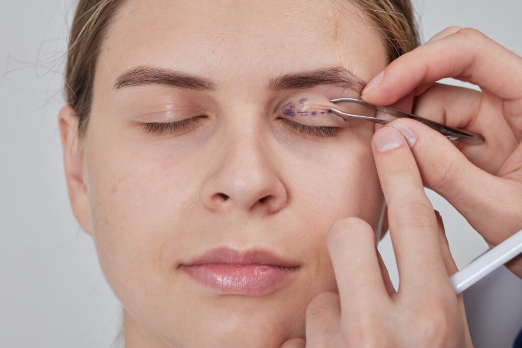 Blefaroplastia sin cirugía, levanta tus parpados caídos y rejuvenece tu mirada. Blefaroplastia sin cirugía, levanta tus parpados caídos y rejuvenece tu mirada.