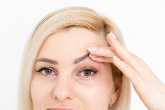Blefaroplastia sin cirugía, levanta tus parpados caídos y rejuvenece tu mirada. Blefaroplastia sin cirugía, levanta tus parpados caídos y rejuvenece tu mirada.