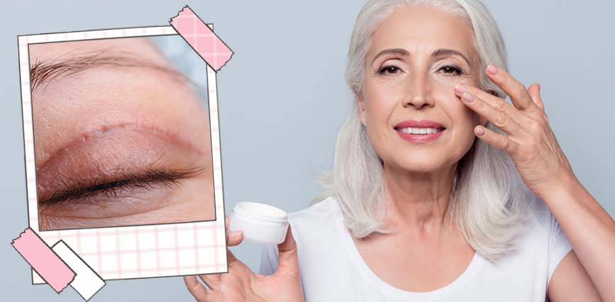 Blefaroplastia sin cirugía, levanta tus parpados caídos y rejuvenece tu mirada. Blefaroplastia sin cirugía, levanta tus parpados caídos y rejuvenece tu mirada.