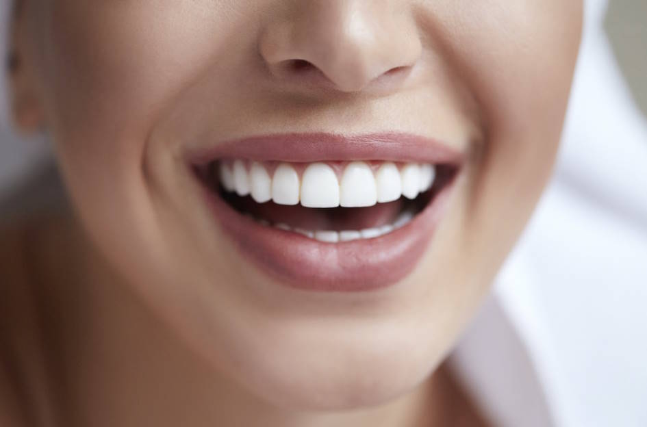 Microcarillas Dentales: Qué Son y Para Qué Sirven 