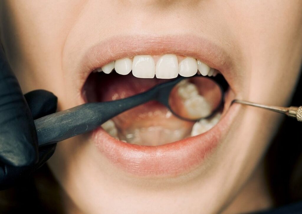 Flemón Dental: Síntomas y Cómo se Trata Flemón Dental: Síntomas y Cómo se Trata