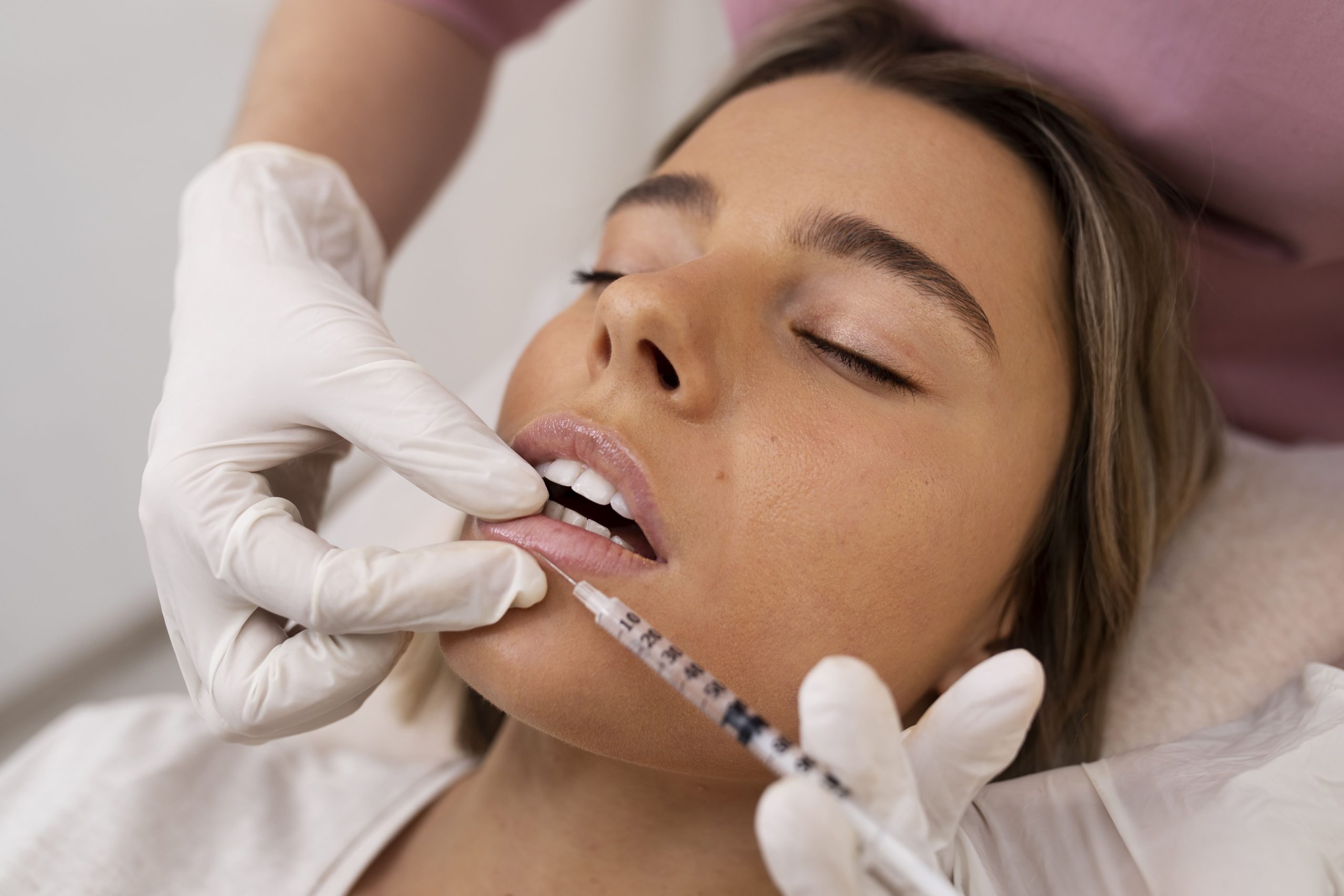 Perfilado y Aumento de Labios con Ácido Hialurónico: Resultado Natural Perfilado y Aumento de Labios con Ácido Hialurónico: Resultado Natural