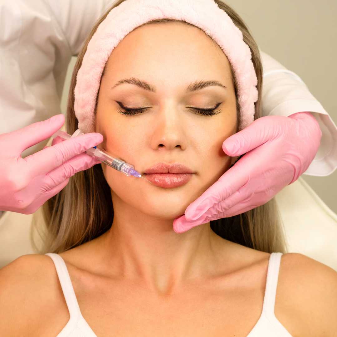 Perfilado y Aumento de Labios con Ácido Hialurónico: Resultado Natural Perfilado y Aumento de Labios con Ácido Hialurónico: Resultado Natural