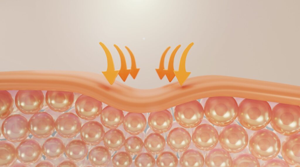 Tratamiento de Cicatrices de Acné: Las Mejores Técnicas para una Piel Lisa Tratamiento de Cicatrices de Acné: Las Mejores Técnicas para una Piel Lisa