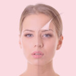 Full Face: Qué es y Cómo Lograr un Equilibrio Estético