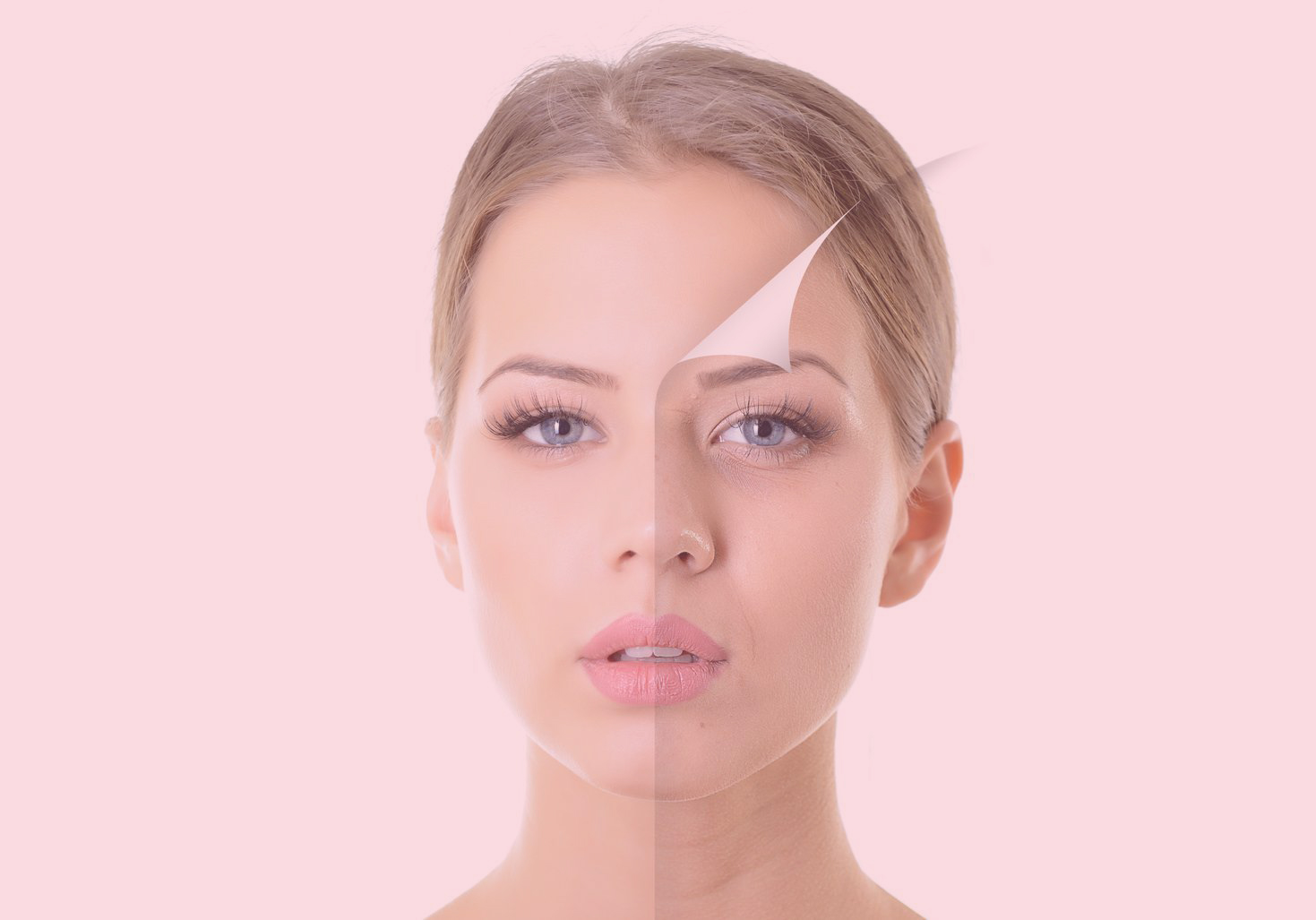 Full Face: Qué es y Cómo Lograr un Equilibrio Estético