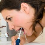 Tonsilolitos (Bolitas blancas en la garganta): Causa del mal aliento