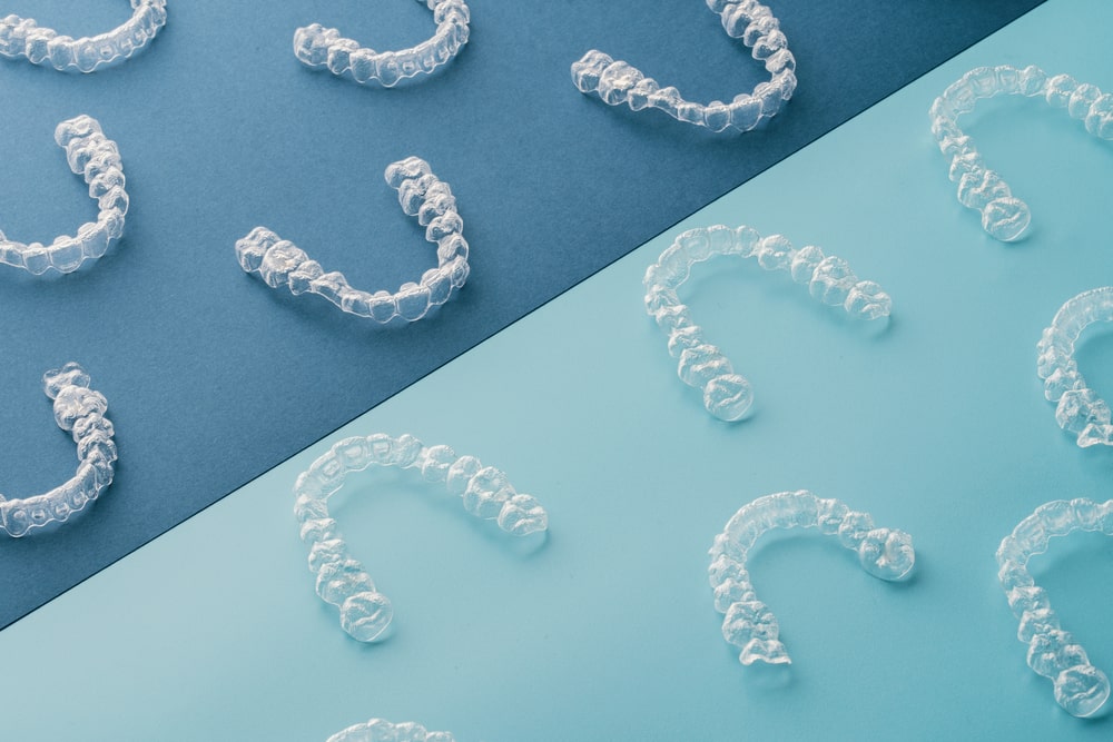 Invisalign vs. Spark: Comparativa de alineadores transparentes