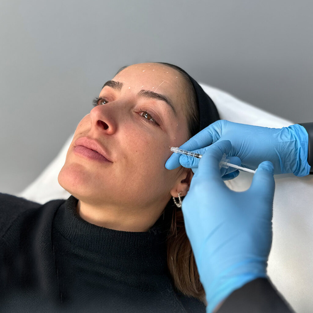 Baby Botox: Qué es y diferencia con el Botox tradicional