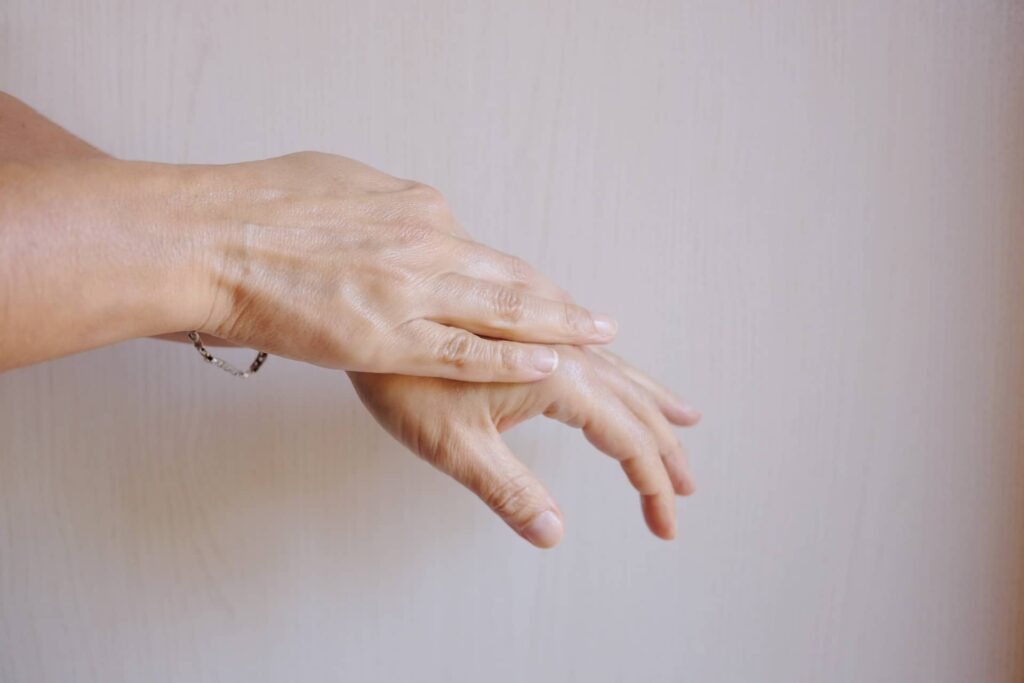 Rejuvenecimiento de manos: Eliminar manchas y venas marcadas