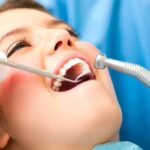 Stripping dental: ¿Duele limar los dientes para ortodoncia?