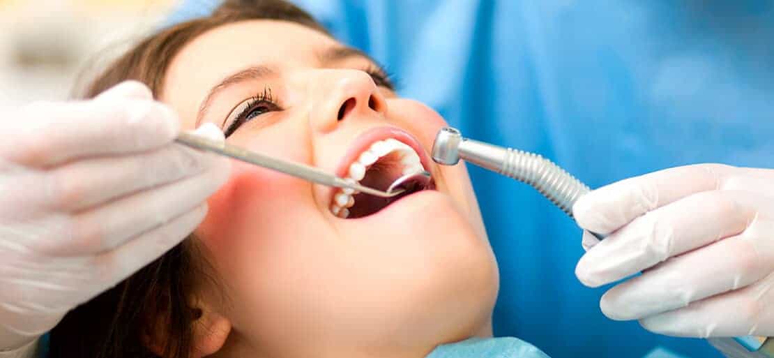 Stripping dental: ¿Duele limar los dientes para ortodoncia?