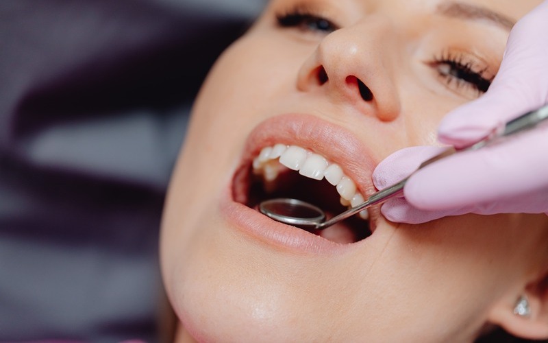 Stripping dental: ¿Duele limar los dientes para ortodoncia?