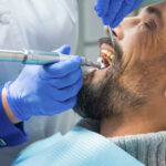 Manchas marrones en los dientes: Diferencias con caries