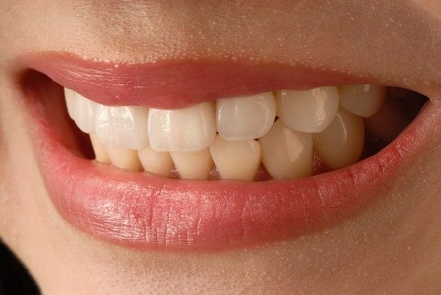 fluorosis dental fluorosis dental