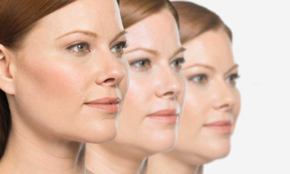 Eliminar papada sin cirugía: Belkyra vs. Enzimas Eliminar papada sin cirugía: Belkyra vs. Enzimas