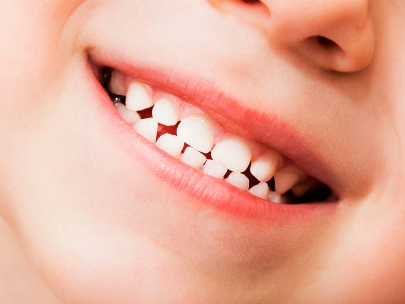 Chupete y dientes: ¿Hasta qué edad es seguro usarlo?