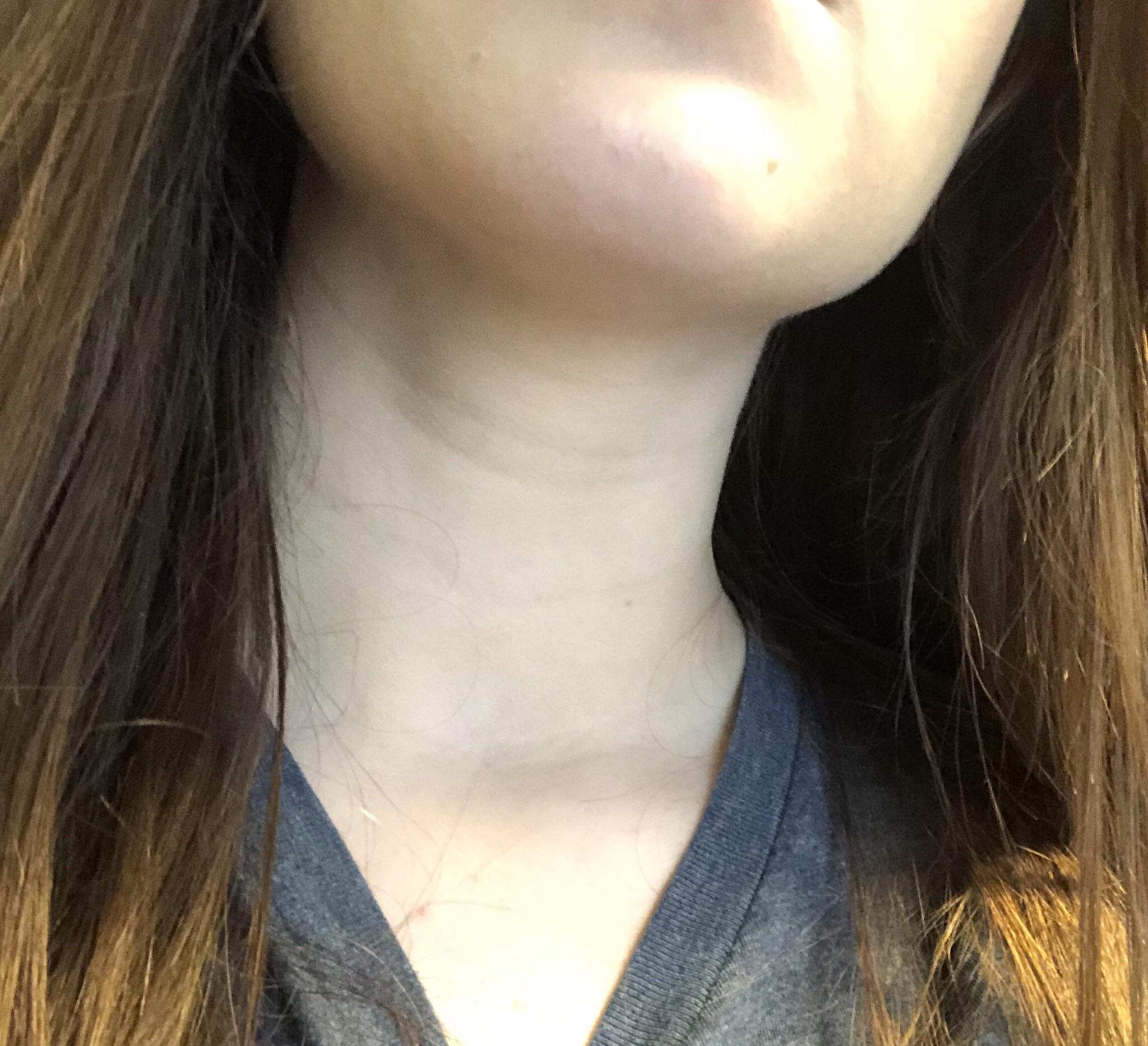 Anillos de Venus: Cómo eliminar las arrugas del cuello