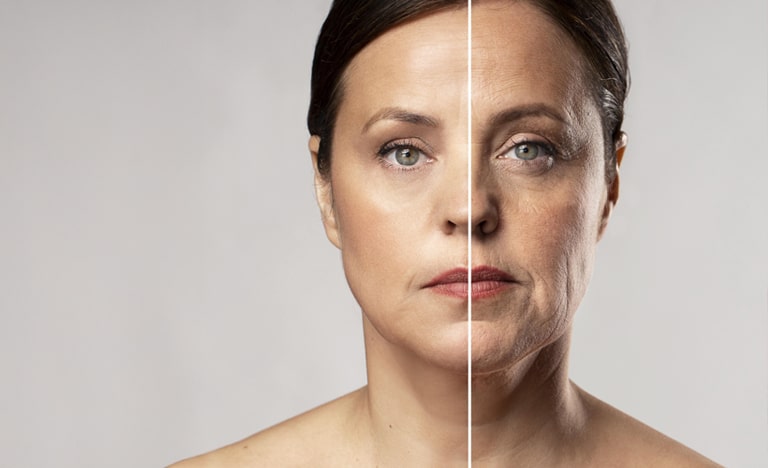 Anillos de Venus: Cómo eliminar las arrugas del cuello